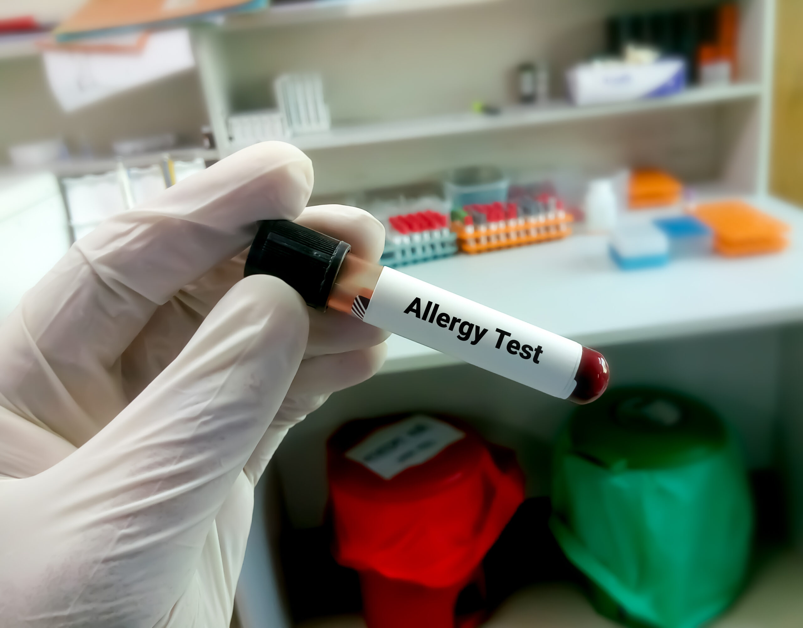 blood allergy test autoimmune disease