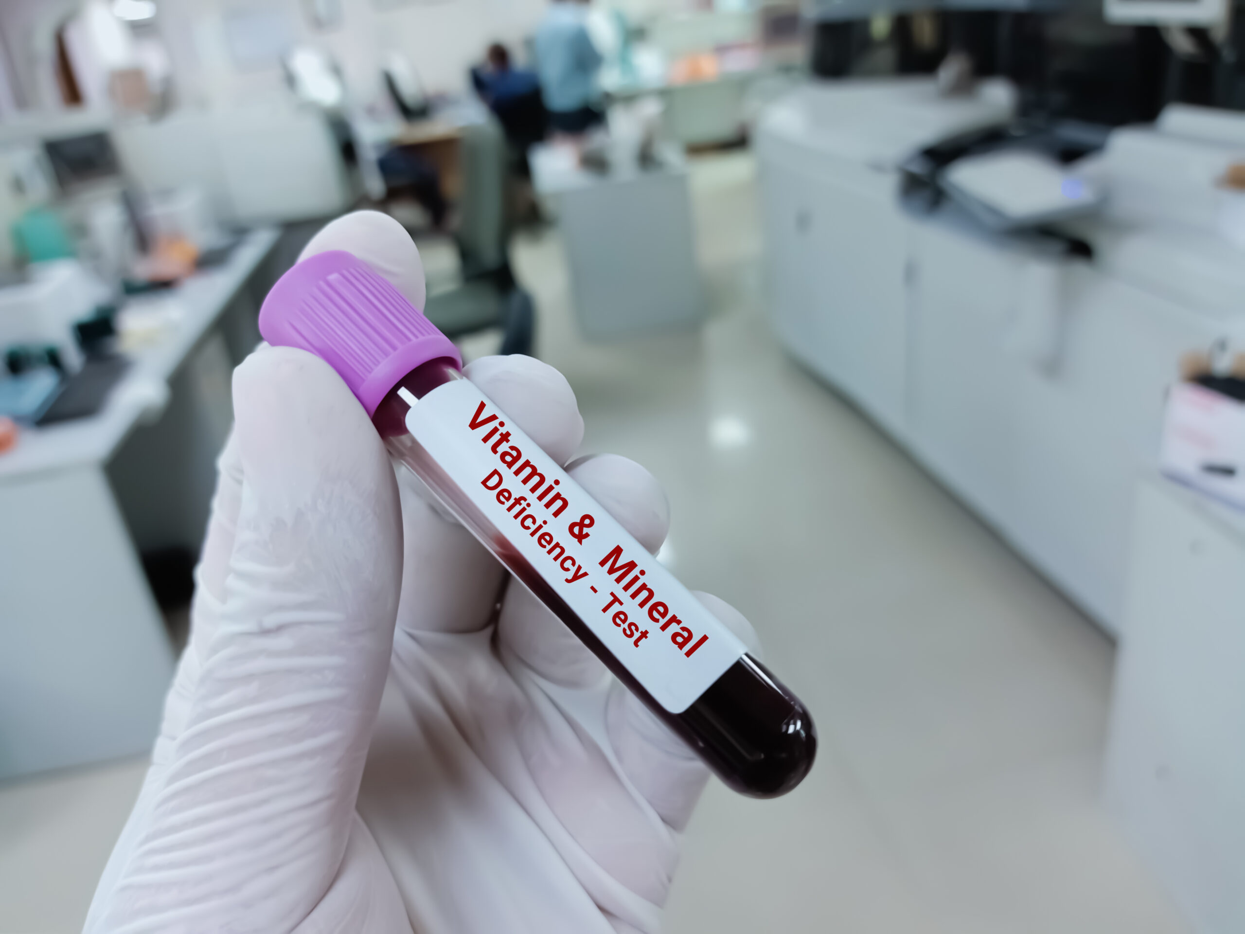 blood sample test vitamin mineral deficiency