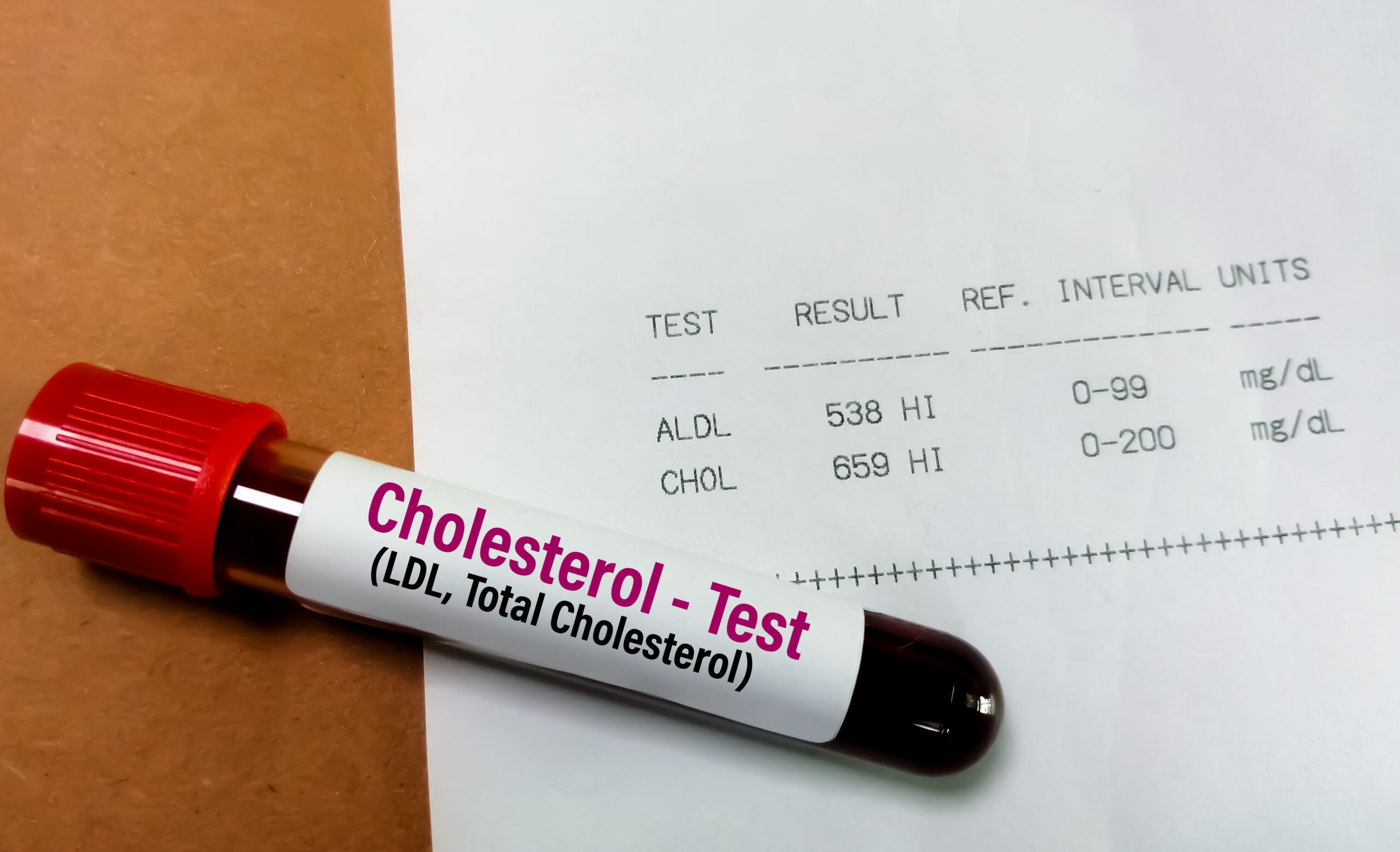 cholesterol blood test