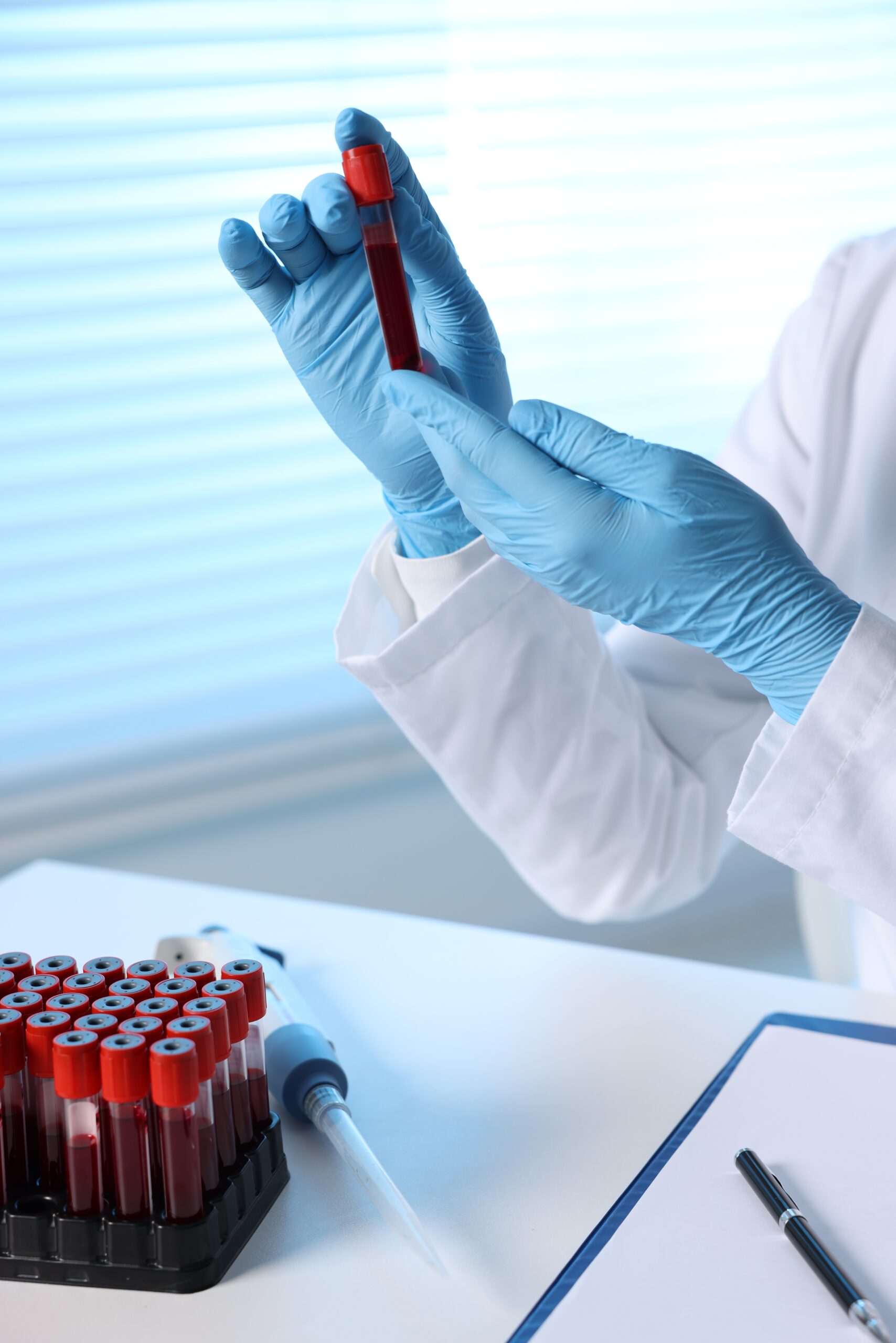 fast blood test testing doctor holding test tube with blood sample table indoors closeup