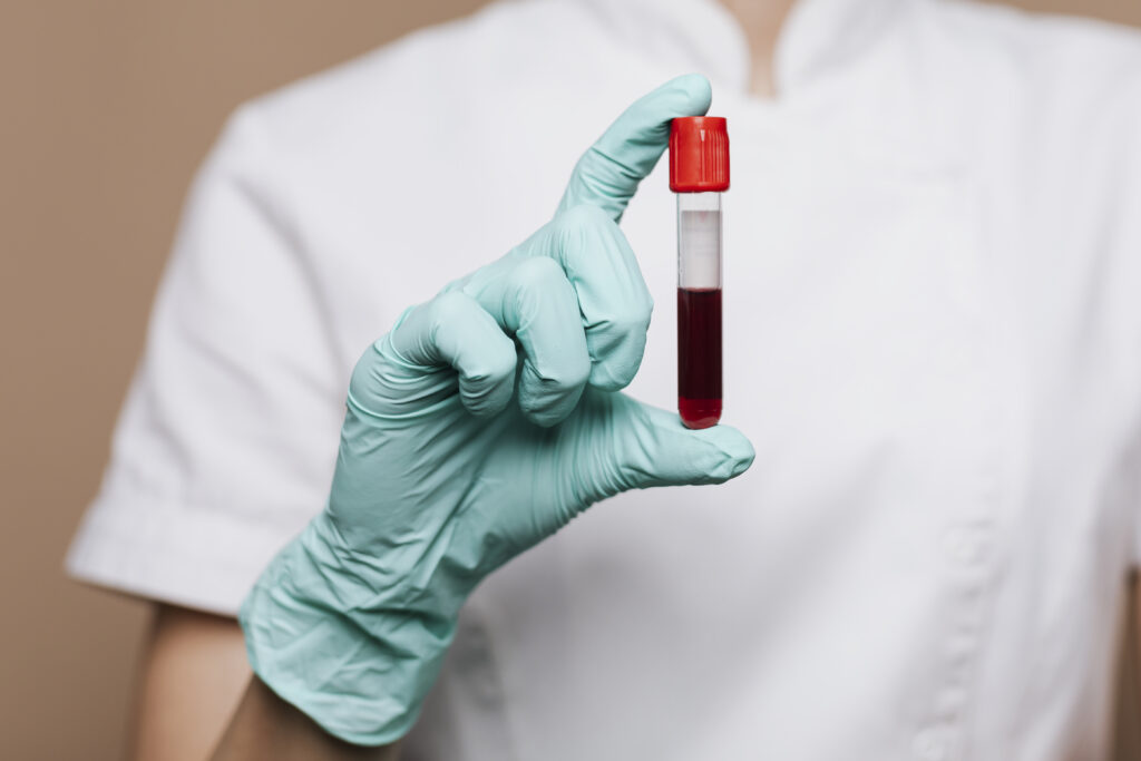 Nurse Holding Blood Test Tube 1024x683