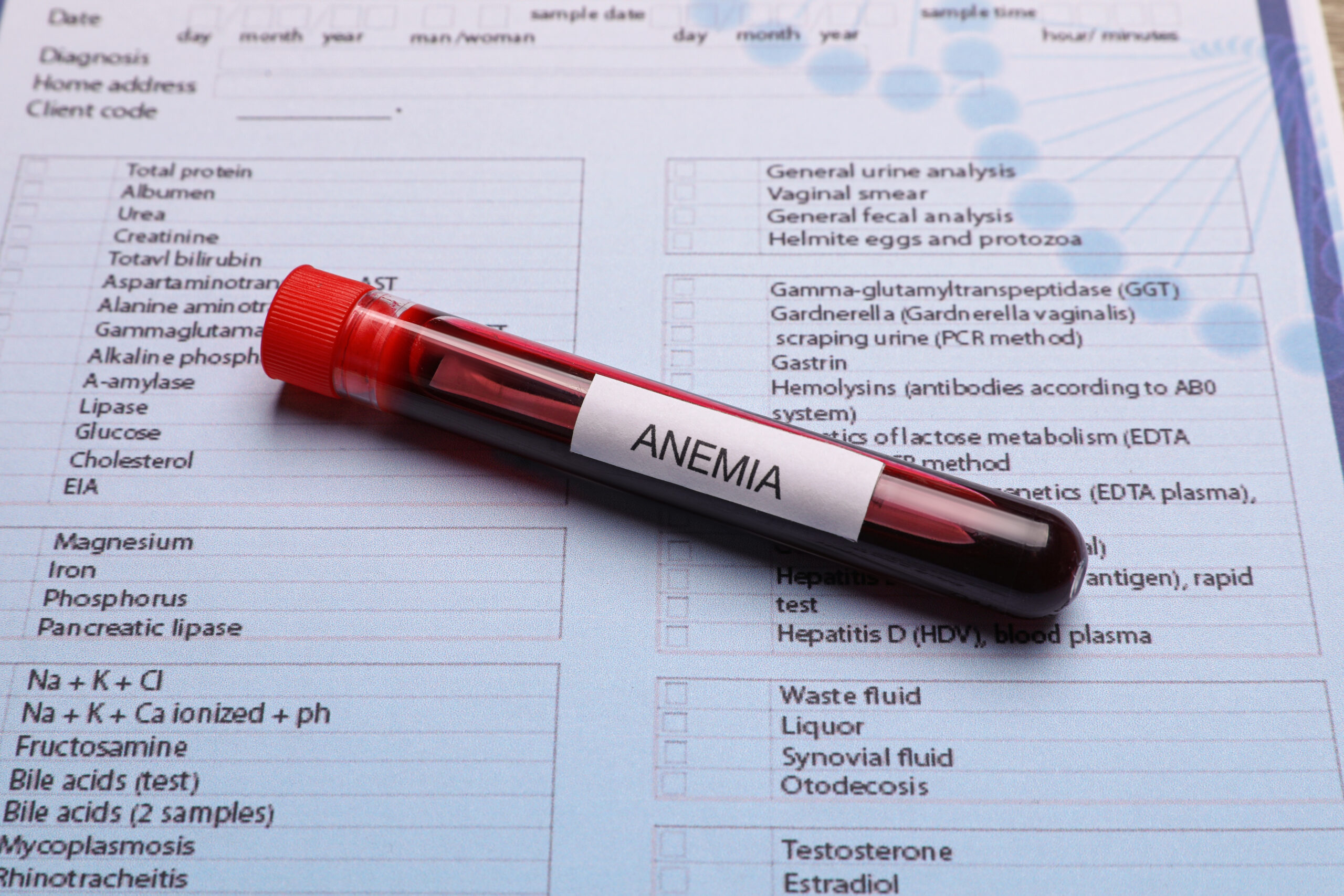anemia blood test